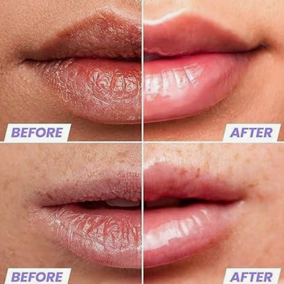 Hydrating Lip Butter Balm