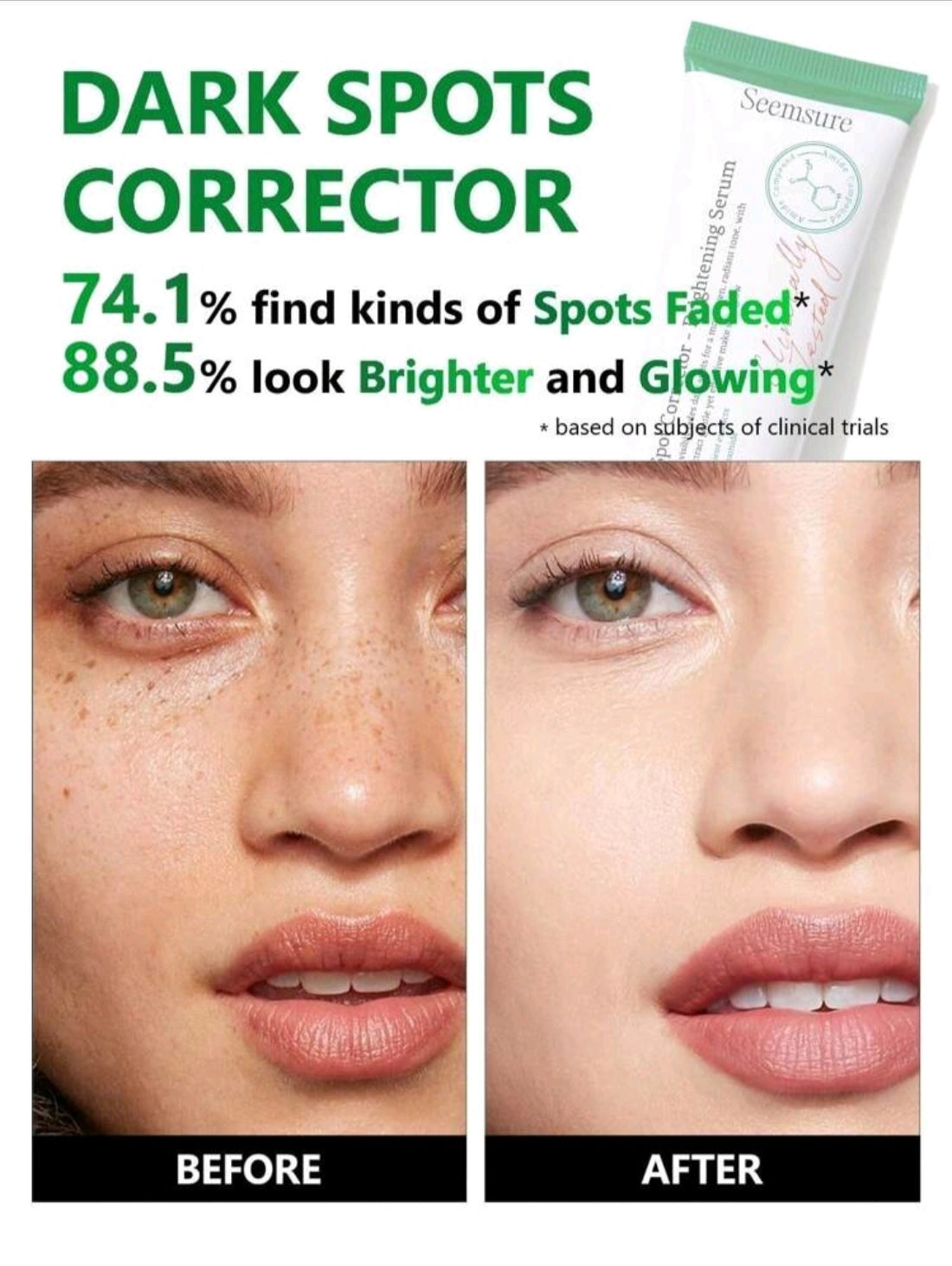 Dark Spot Corrector