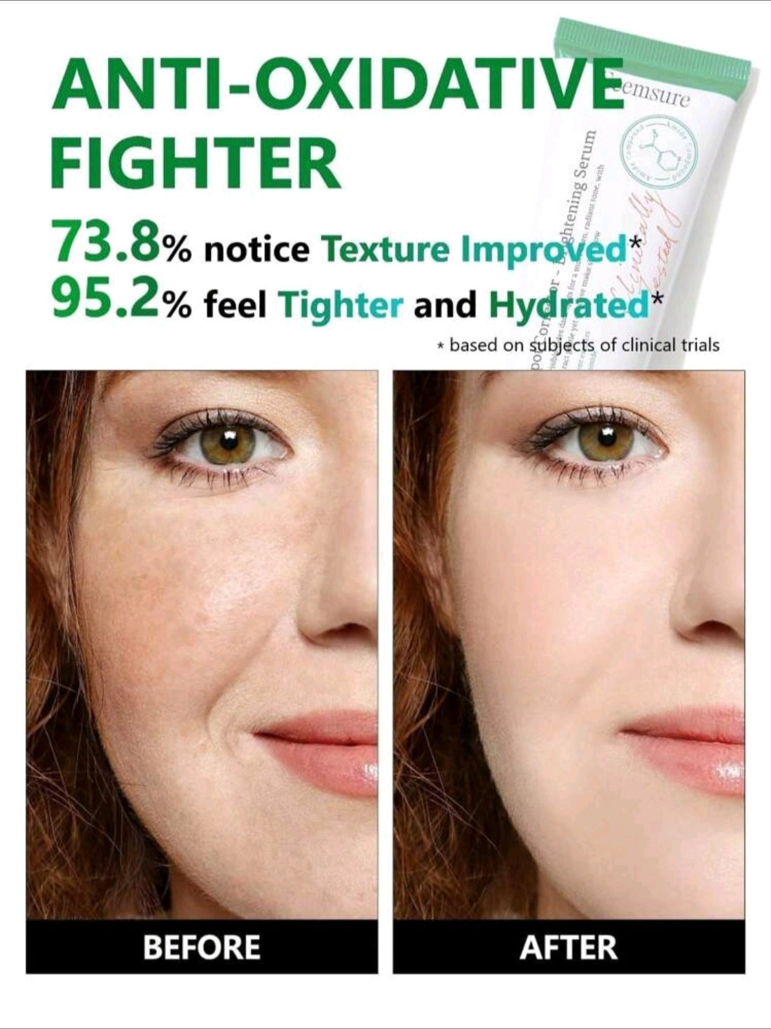 Dark Spot Corrector