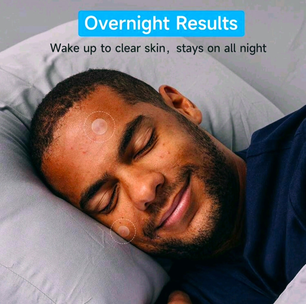 36 Hydrocolloid Acne Pimple Patches, Day & Night Spot Patches
