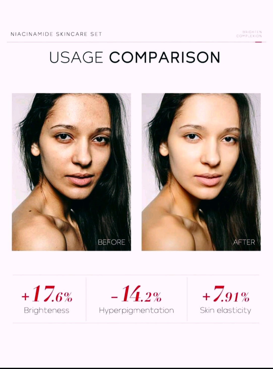 4-Piece Niacinamide Skincare Set