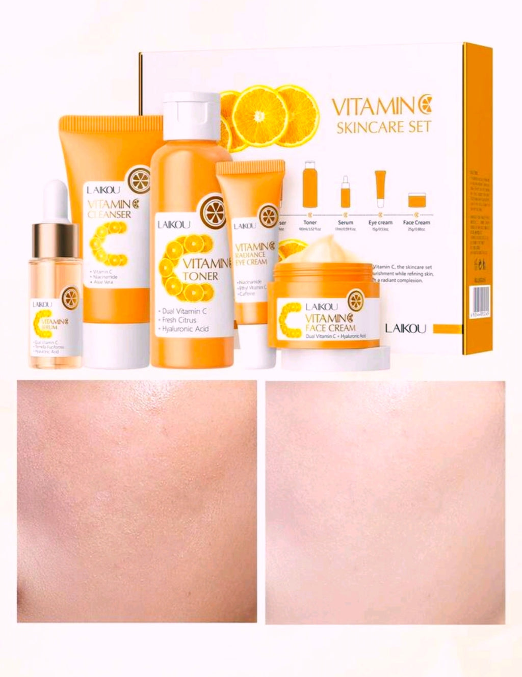 5-Piece Vitamin C Brightening Skincare Set