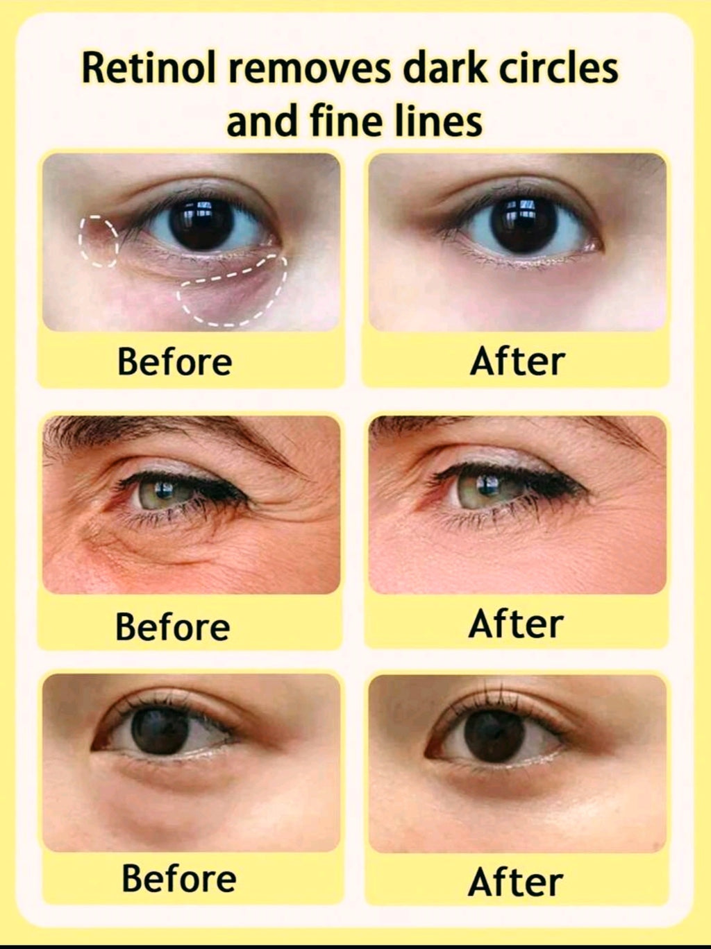 Instant Temporary Eye Tightener Cream