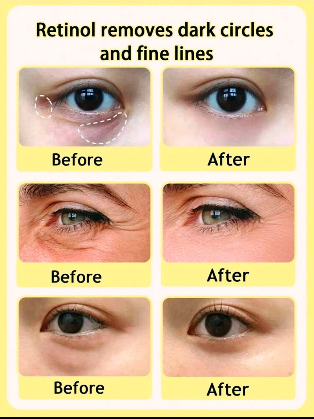 Instant Temporary Eye Tightener Cream